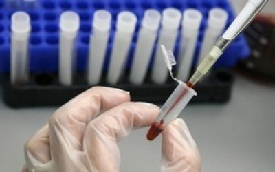 Проводится генетическая экспертиза подозреваемых в организации теракта в Домодедово